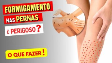 FORMIGAMENTO NAS PERNAS É PERIGOSO? O Que Pode Ser? O Que Fazer?